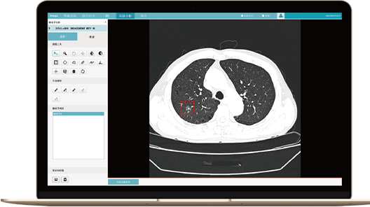 Photon Algorithm Set - Accurate Diagnosis